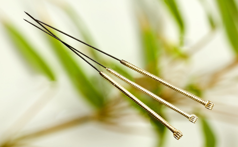 acupuntura